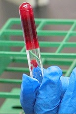 Test tube of human blood gelled by our modified chitosan. Photo taken in the Raghavan lab in 2007